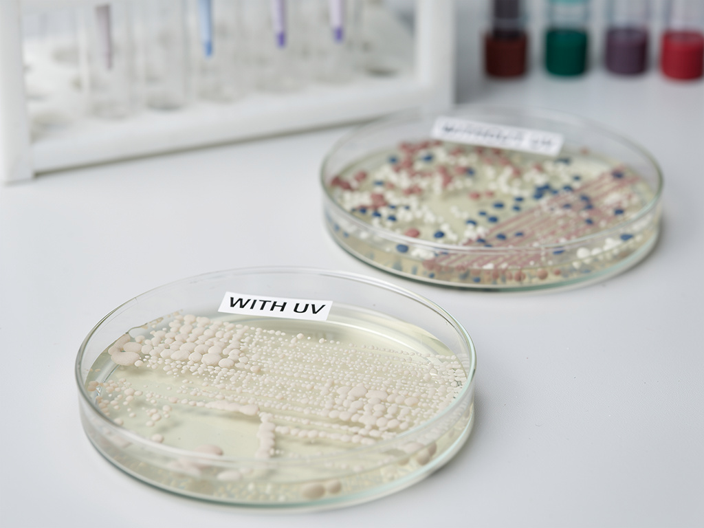 Effect of UV Light on Bacterial Growth Science Fair Project